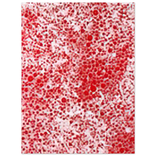 Yayoi Kusama - BEYOND THE END OF THE CENTURY 1987 Fine Art Poster