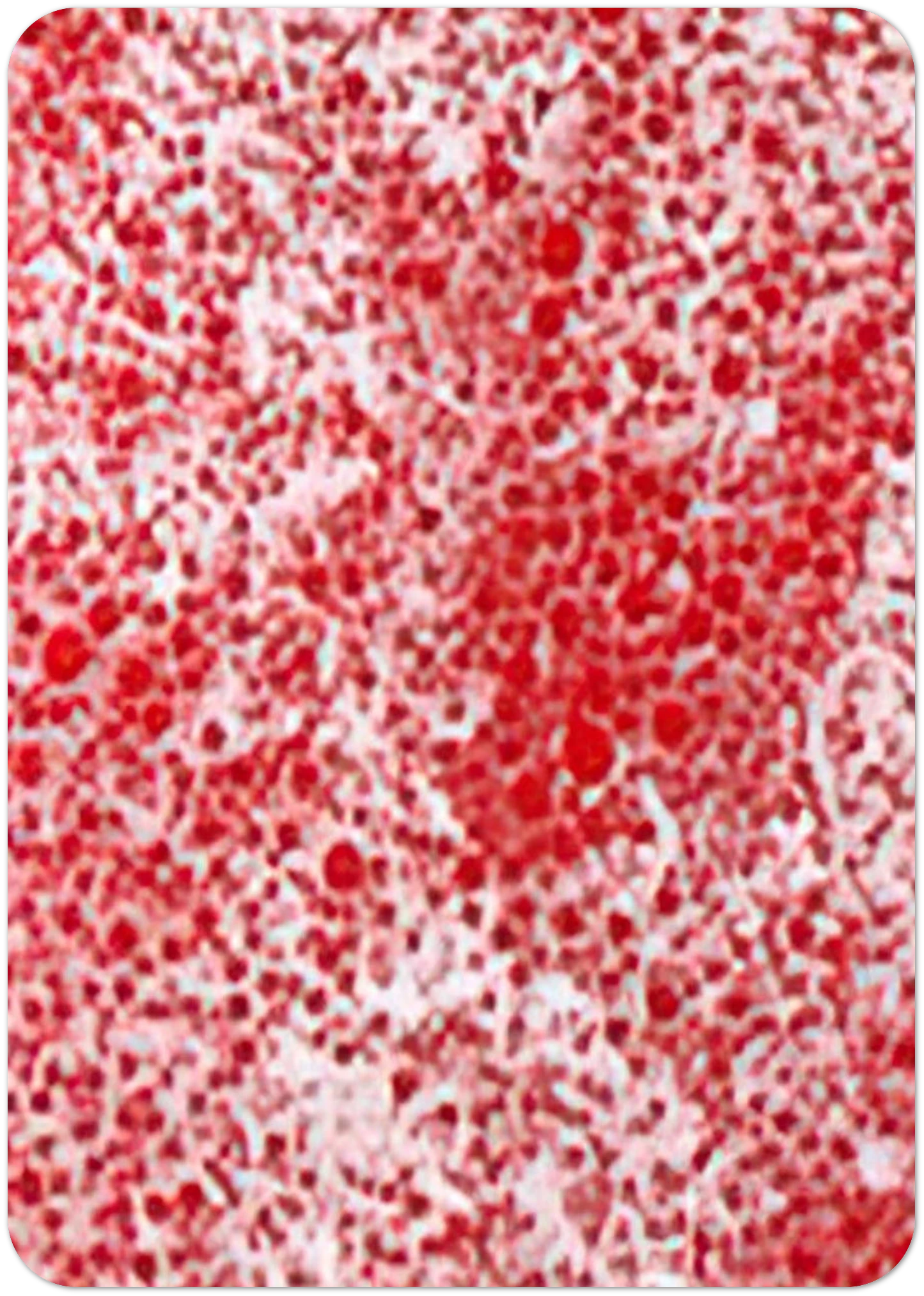 BEYOND THE END OF THE CENTURY 1987 By Yayoi Kusama Pack of 10 Post Cards | Yayoi Kusama Post Cards | A6 (10.5 x 14.8 cm) - 4.1 x 5.8 inches
